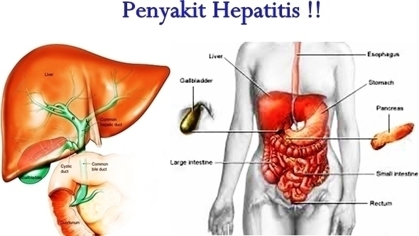 Hepatitis C di luar badan dan fakta-fakta virus lain