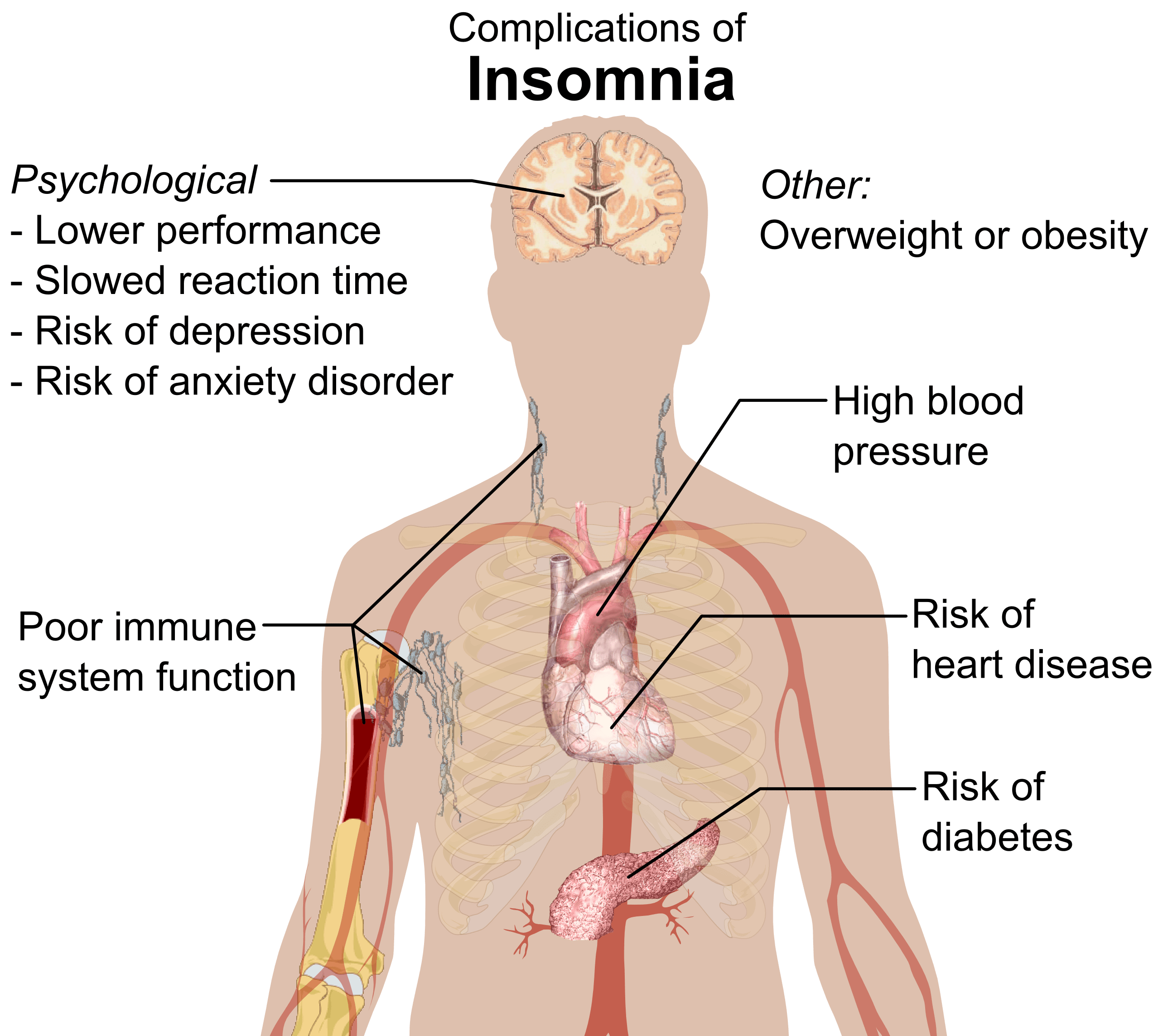 Insomnia boleh menimbulkan risiko penyakit buah pinggang dan kematian
