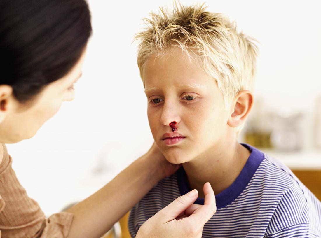Kanak-kanak dengan nosebleed dihiburkan oleh ibu
