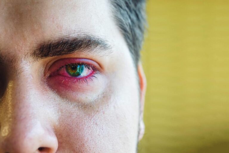 Apa yang boleh menyebabkan kelopak mata yang sakit?