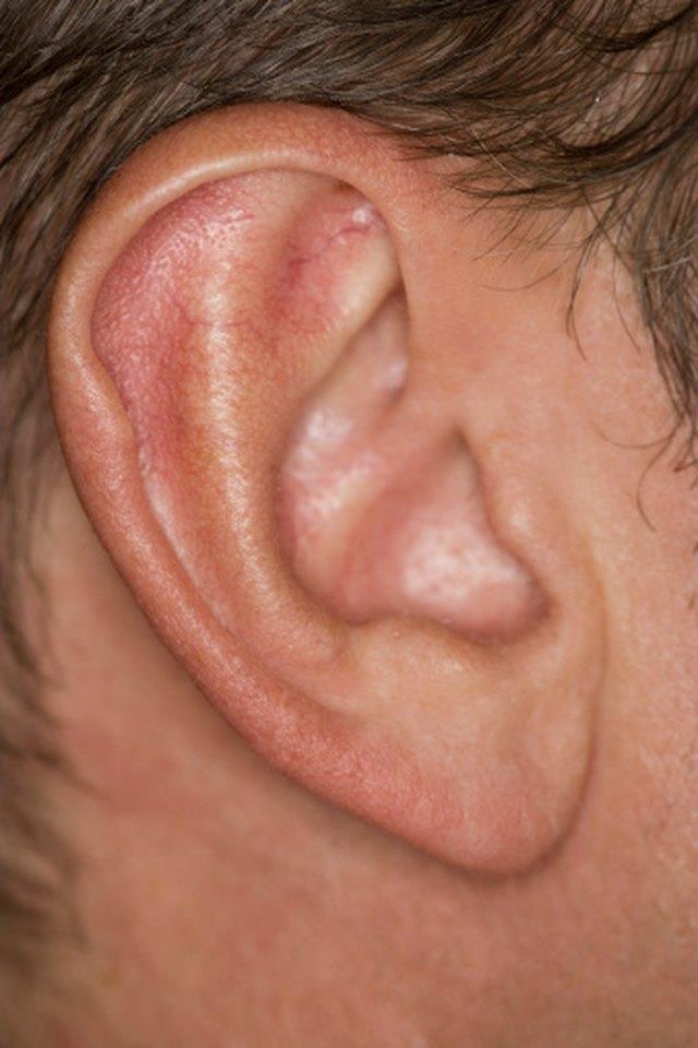 Tinnitus – Mengapa ada deringan di telinga saya?