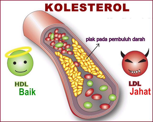 Apakah nisbah HDL kolesterol yang baik?